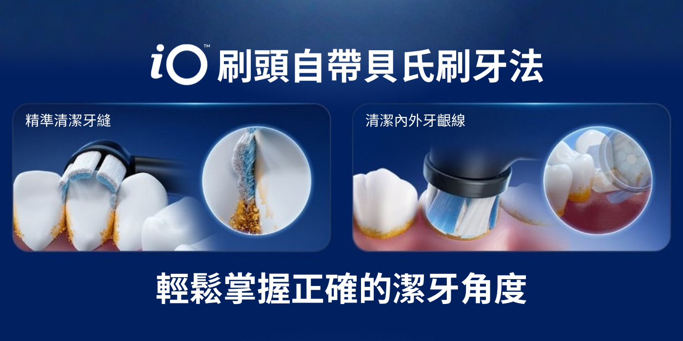 blog image 貝氏刷牙法